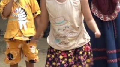 Semangat Bersekolah Walau tak Punya Telapak Tangan dan Kaki